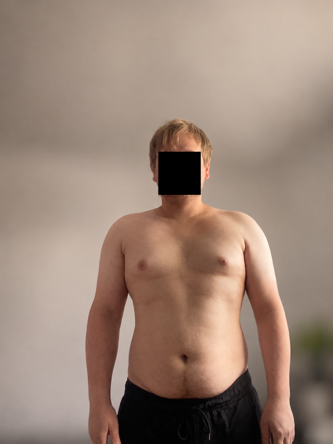 Nachher – Ansicht 1