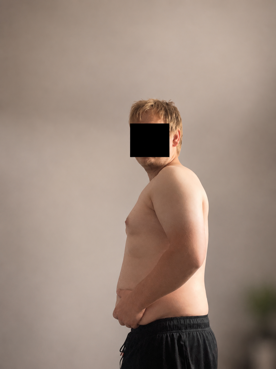 Nachher – Ansicht 2