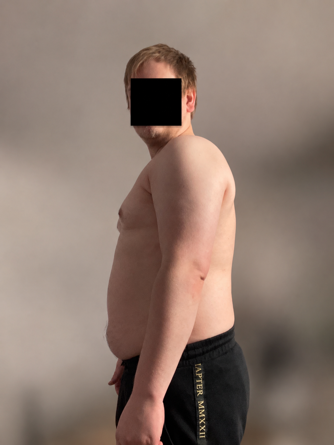 Vorher – Ansicht 2